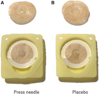 Efficacy of chronic neck pain self-treatment using press needles: a randomized controlled clinical trial